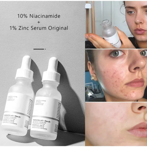 The Ordinary Niacinamide 10% + Zinc 1% - 30ml