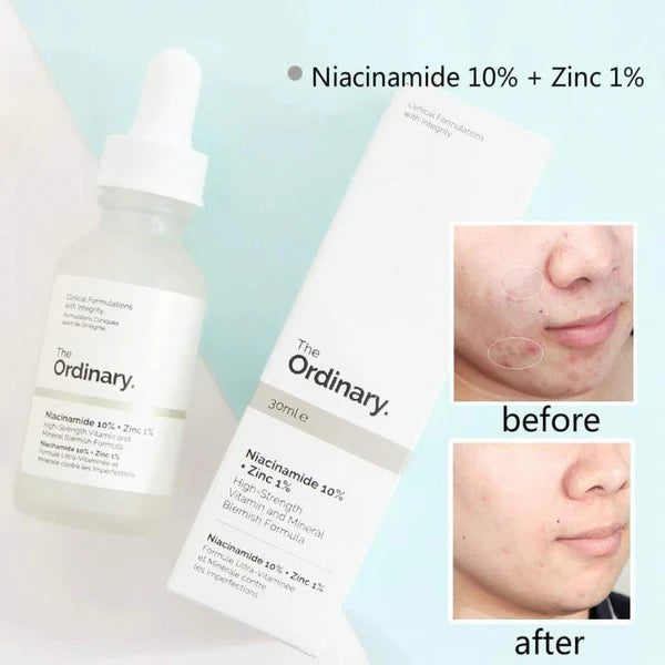 The Ordinary Niacinamide 10% + Zinc 1% - 30ml